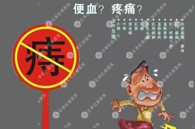 福州治痔疮医院哪家好